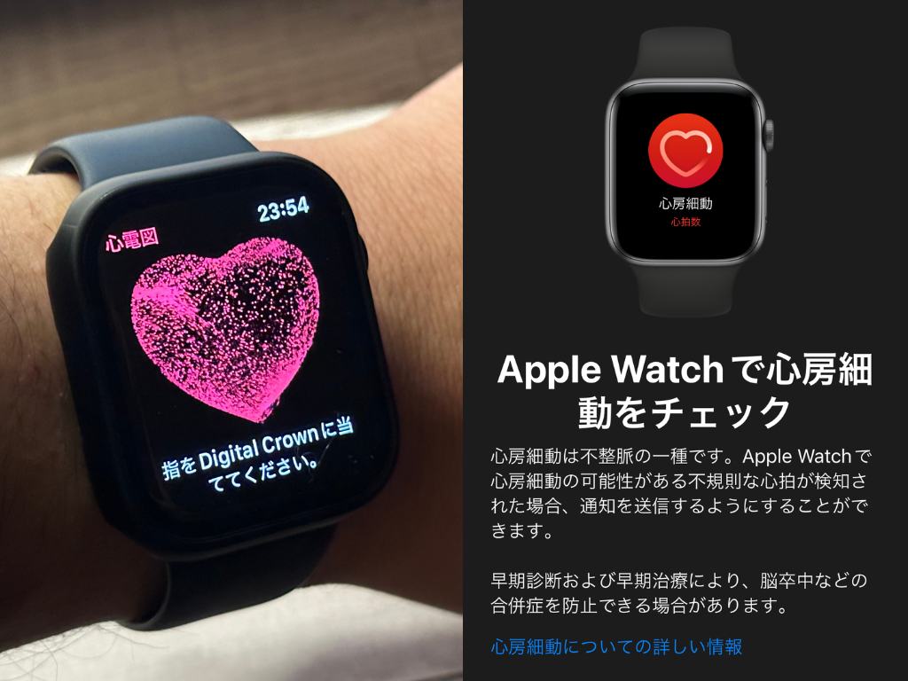 Apple Watch Series 8 心電図